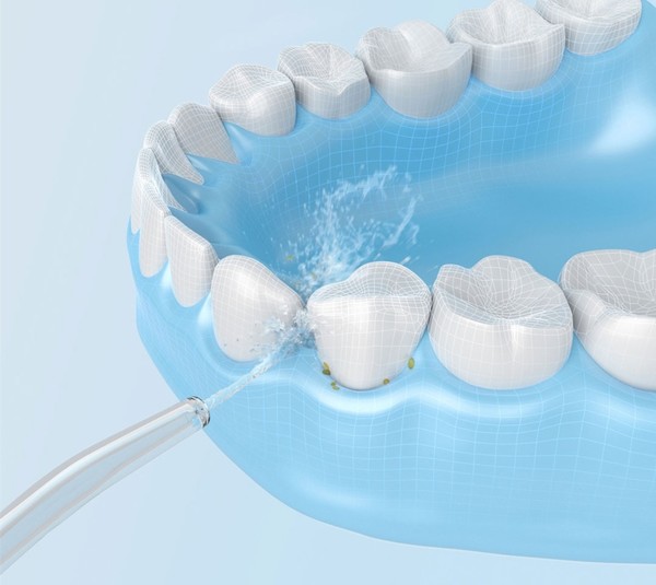 electric tooth water flosser