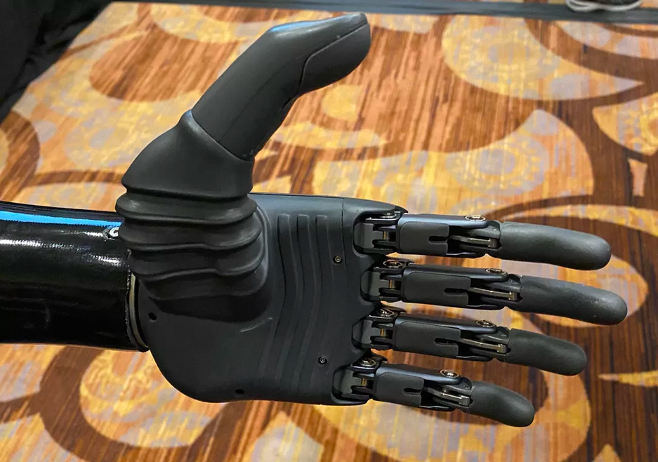 New AI Powered Prosthetic Hand can be moved with your Mind Gizmochina