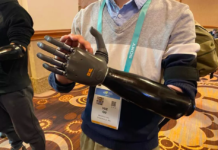 New AI Powered Prosthetic Hand can be moved with your Mind