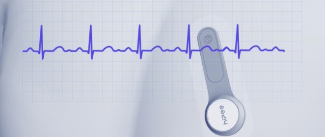 HiPee Dynamic ECG Recorder