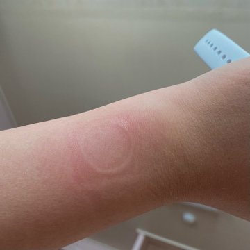 Few Apple Watch SE users in South Korea experience wrist burn