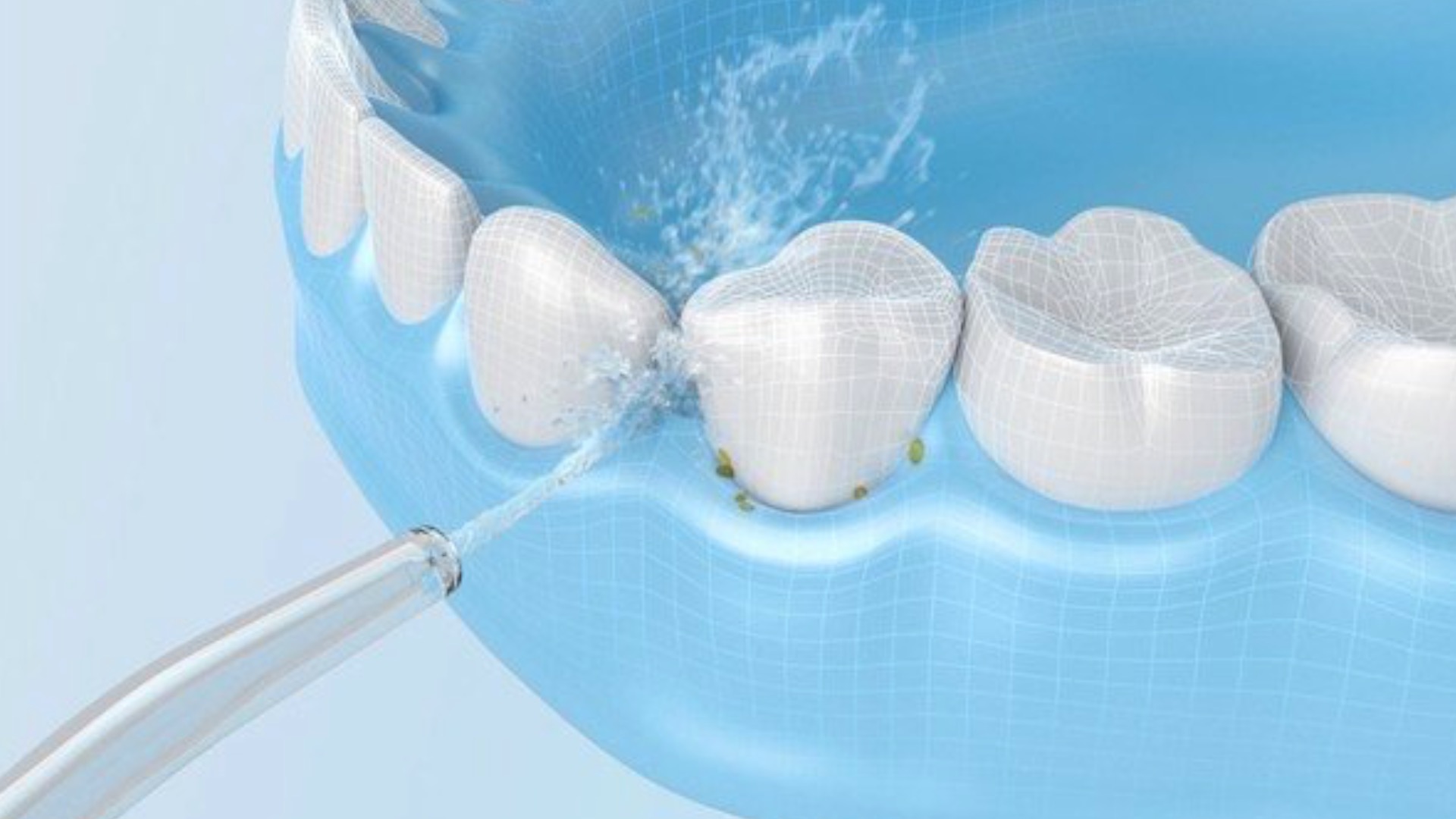 Беспроводной ирригатор xiaomi dr. Ирригатор xiaomi mijia meo701. Ирригатор teeth flosser xiaomi f300. Ирригатор teeth flosser xiaomi f300. Ирригатор f3.