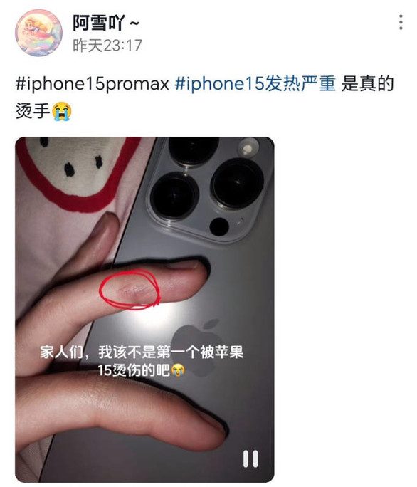 iPhone-15-overheating-burning