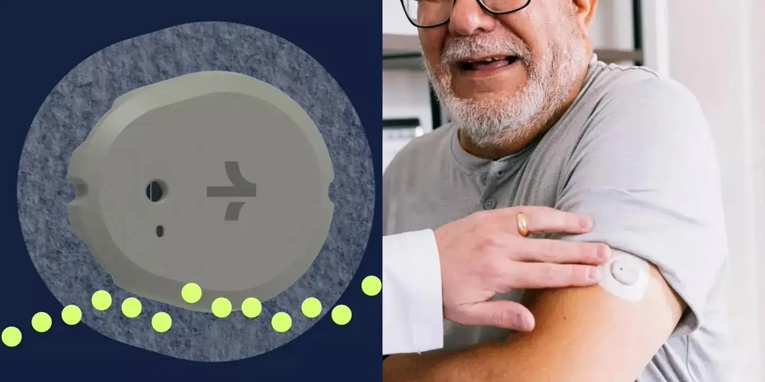 Dexcom Stelo Glucose Sensor