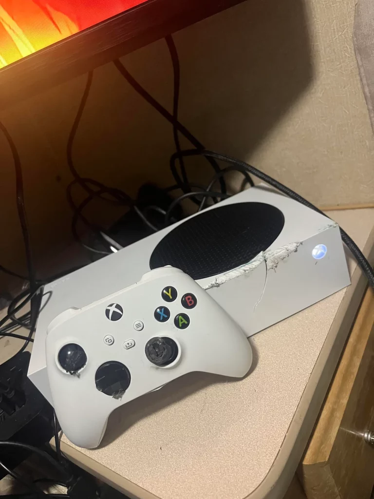 xbox-series-s-saved-life