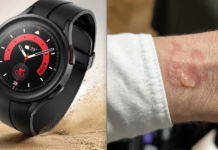 Overheating Galaxy Watch 5 Pro drains completely overnight, causes a blister on the wrist