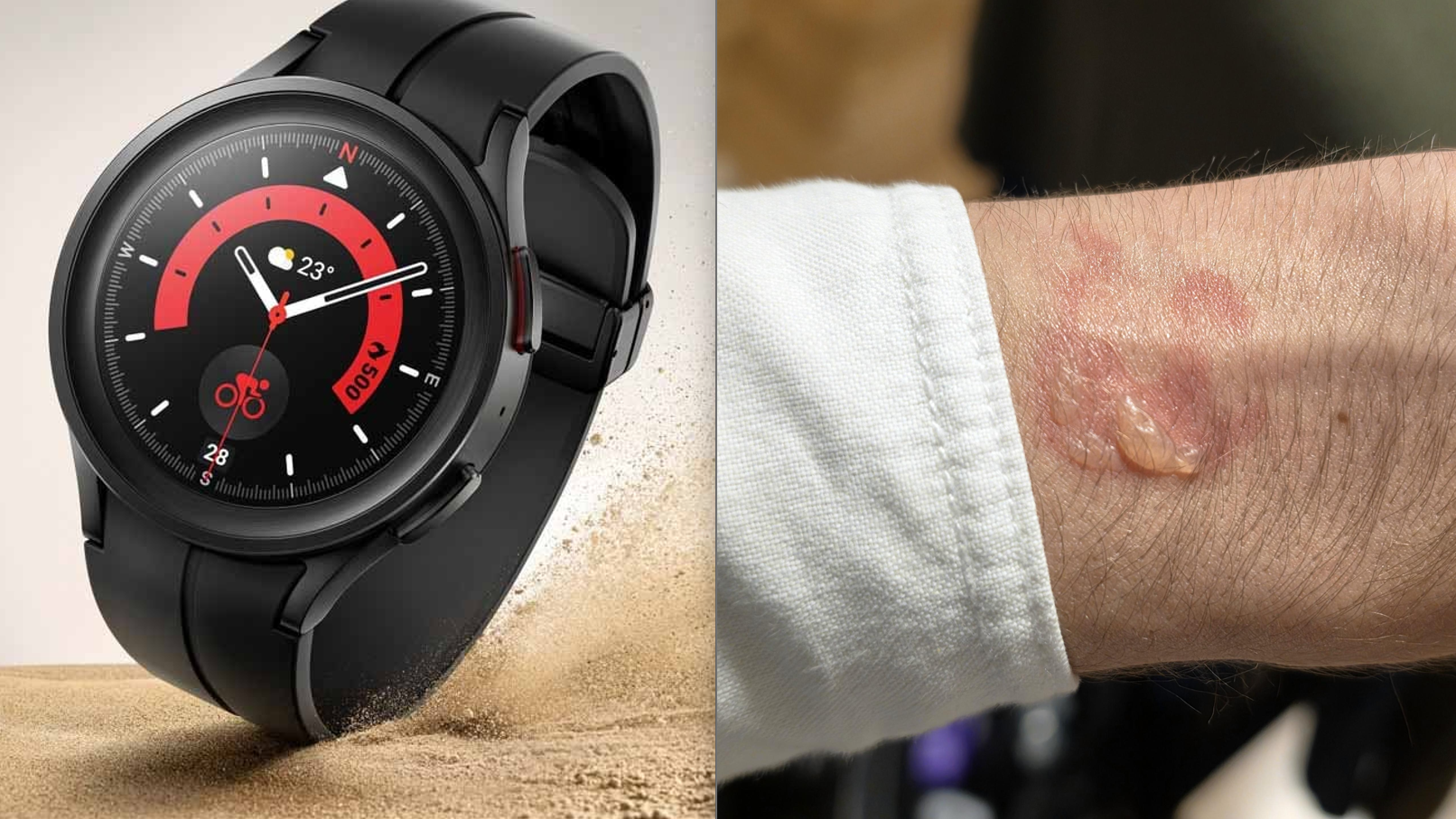 Overheating Galaxy Watch 5 Pro drains completely overnight, causes a blister on the wrist
